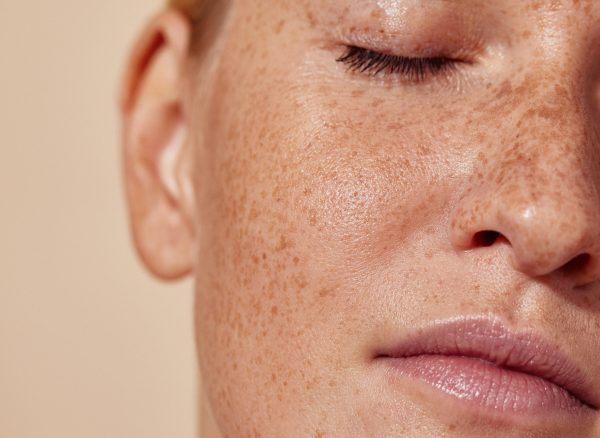 Cropped shot of the face of a young woman with freckles Cropped shot of the face of a young woman with freckles