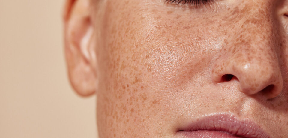 Cropped shot of the face of a young woman with freckles